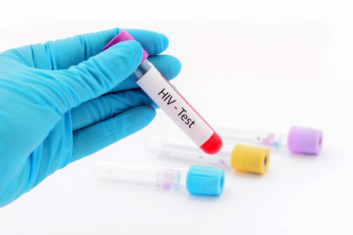 HIV Test Dubai - Fast, Confidential & Accurate Testing