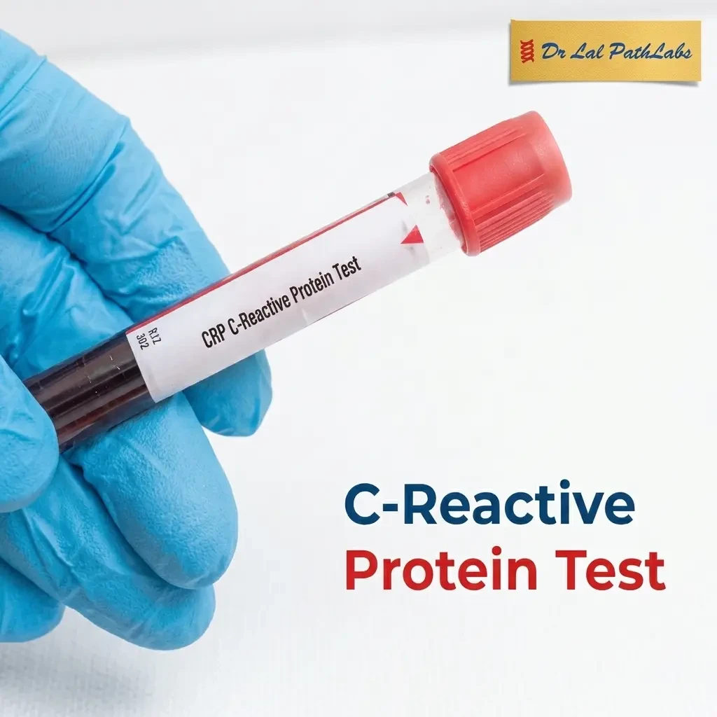 Ultra-Sensitive C-Reactive Protein (CRP-US) Test: Accurate Inflammation Detection for Cardiovascular, Diabetes, and Autoimmune Health
