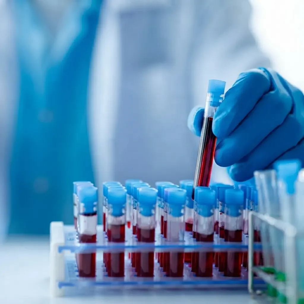 High-Purity Albumin Protein for Serum Analysis | Spectrophotometry Method | 1-Day TAT | Essential for Health, Recovery & Research