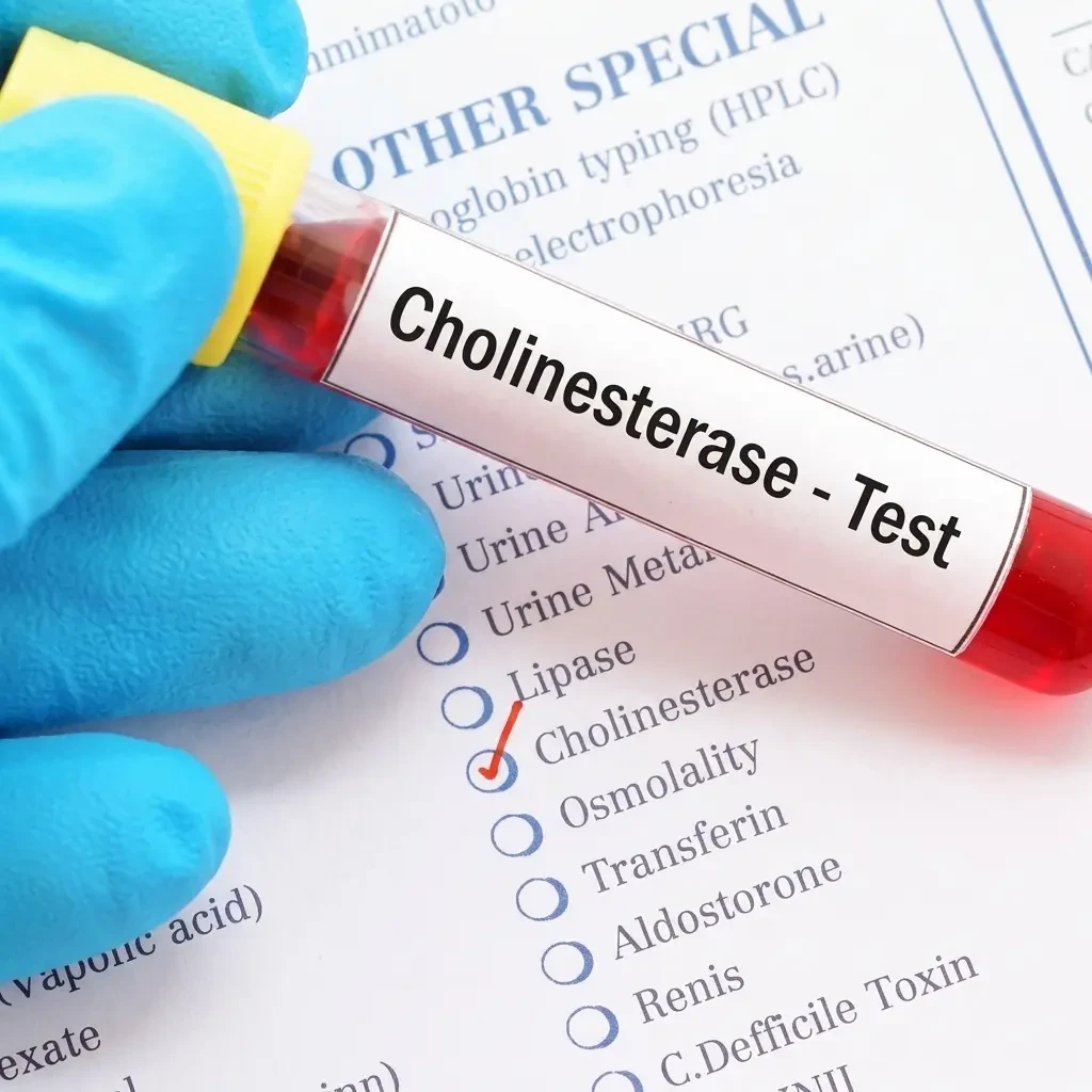High-Purity Cholinesterase Enzyme for Serum Analysis | Flow Cytometry | Neurobiological Research & Diagnostics | 10-Day TAT