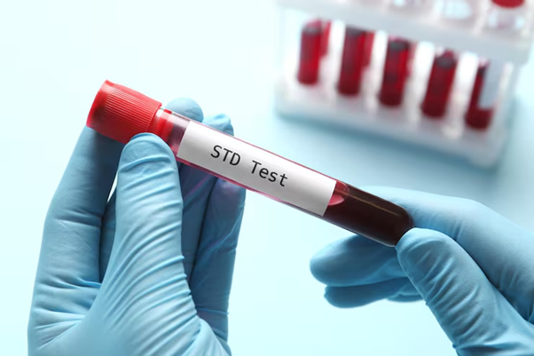 Why Choosing a Professional STD Clinic in Dubai Matters for Your Health