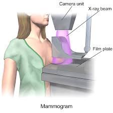 Mammogram (Bilateral) Screening – Accurate Breast Health Assessment