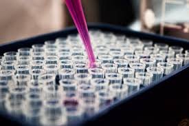 Comprehensive Heavy Metal and Trace Element Urine Test – 21 Elements Analysis for Toxicity & Nutritional Balance