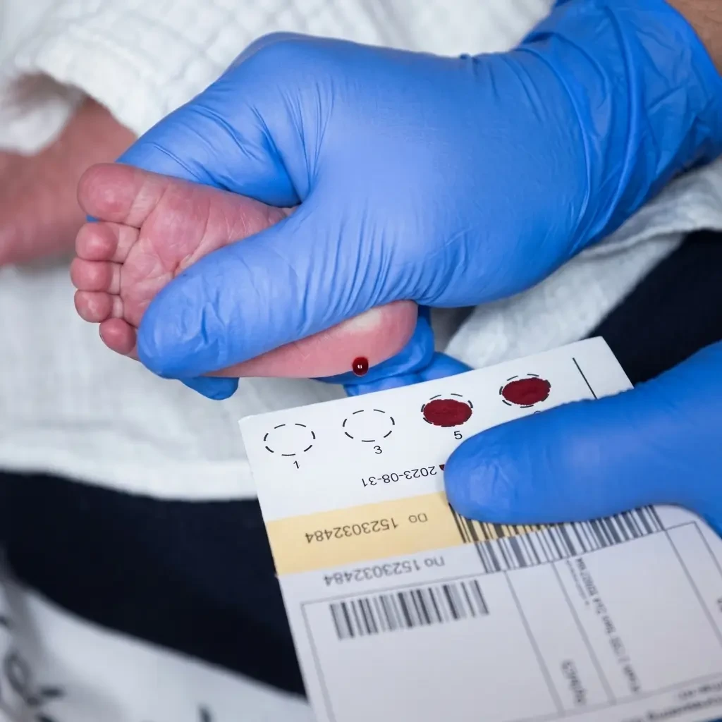 Newborn Guthrie Test (PKU) – Heel Prick Blood Screening for Early Detection of Metabolic Disorders