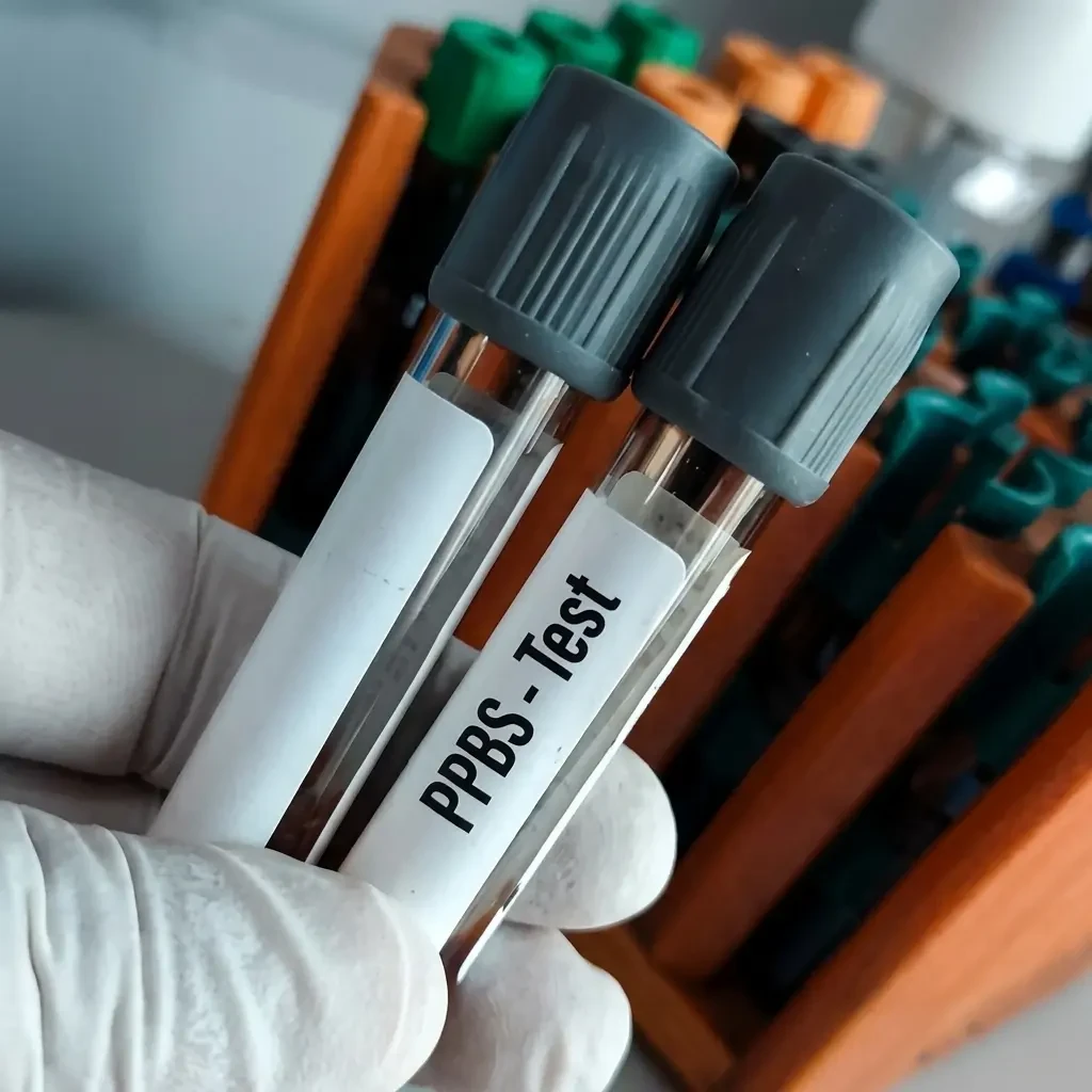Postprandial Glucose Test – Accurate Plasma-Based Spectrophotometry for Metabolic Health Insights in 1 Day