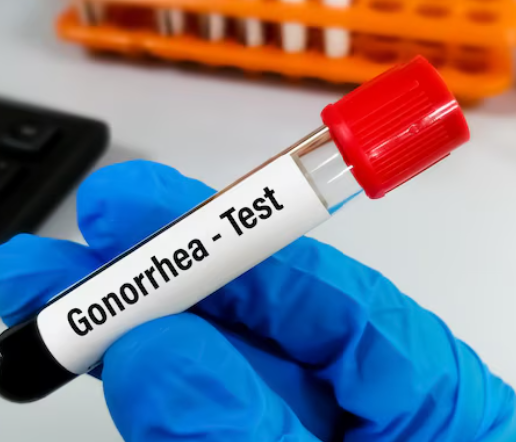 Gonorrhea Test Dubai