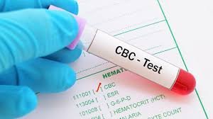 Complete Blood Count (CBC)
