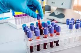 ROS1 FISH Test – Accurate Genetic Testing for Targeted Cancer Therapy