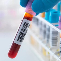 BLOOD TEST DUBAI
