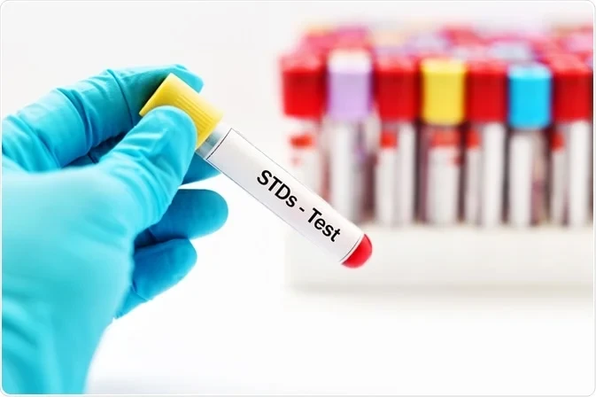 Sexually Transmitted Diseases (STDs): Testing, Diagnosis, and Treatment in Dubai