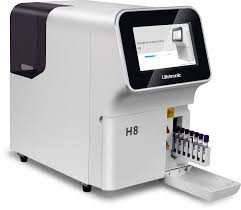 Accurate HbA1c Testing with HPLC: High-Performance Liquid Chromatography for Whole Blood Analysis in Diabetes Management