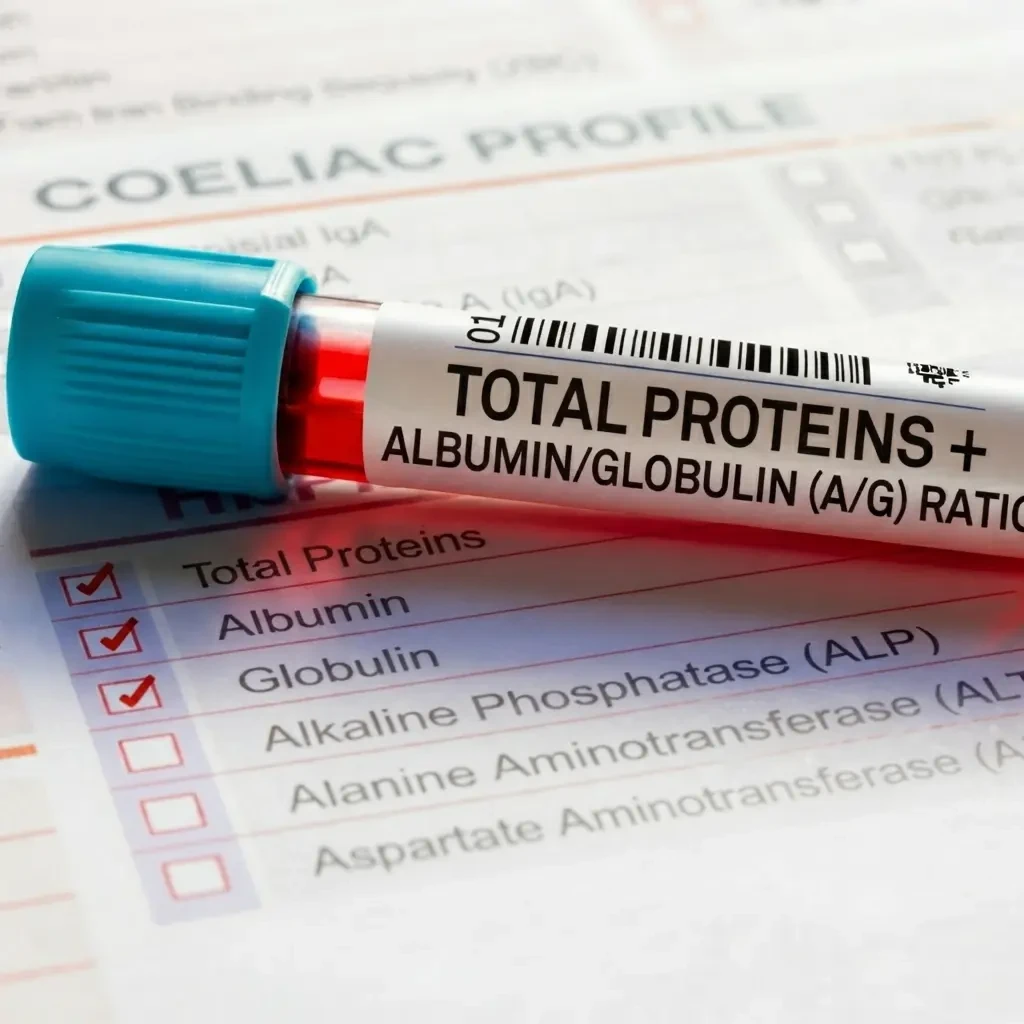 Comprehensive Albumin/Globulin (A/G) Ratio Test - Accurate Serum Analysis via Spectrophotometry for Protein Balance & Health Insights