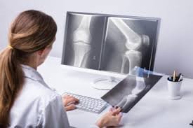 Comprehensive High-Quality X-Ray Three View Imaging for Accurate Diagnosis