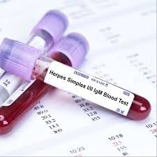 Herpes Simplex Full Profile