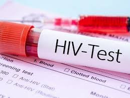 HIV Test at Home in Dubai – Private, Fast & Confidential Screening