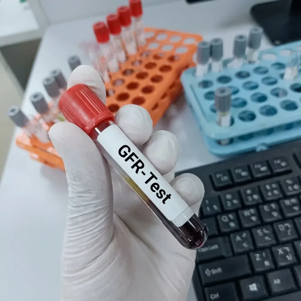 Glomerular Filtration Rate (GFR) Test: Accurate Kidney Function Assessment via Serum Spectrophotometry – Fast 1-Day TAT