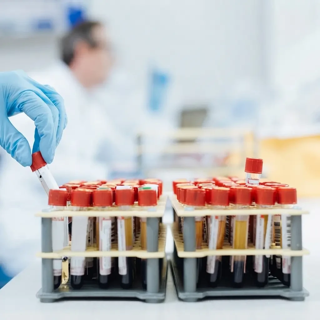 Alanine Aminotransferase (ALT/GPT) Test Kit – Accurate Liver Function Marker for Serum Analysis via Spectrophotometry
