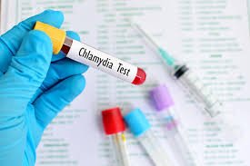 Chlamydia Test Dubai